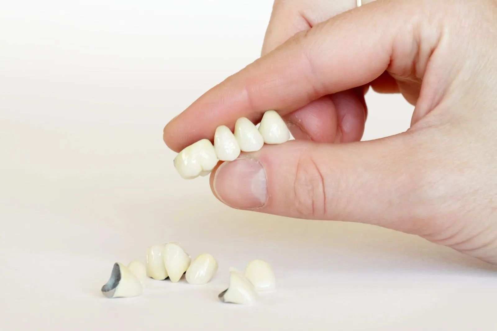 a hand holding dental crowns and bridges