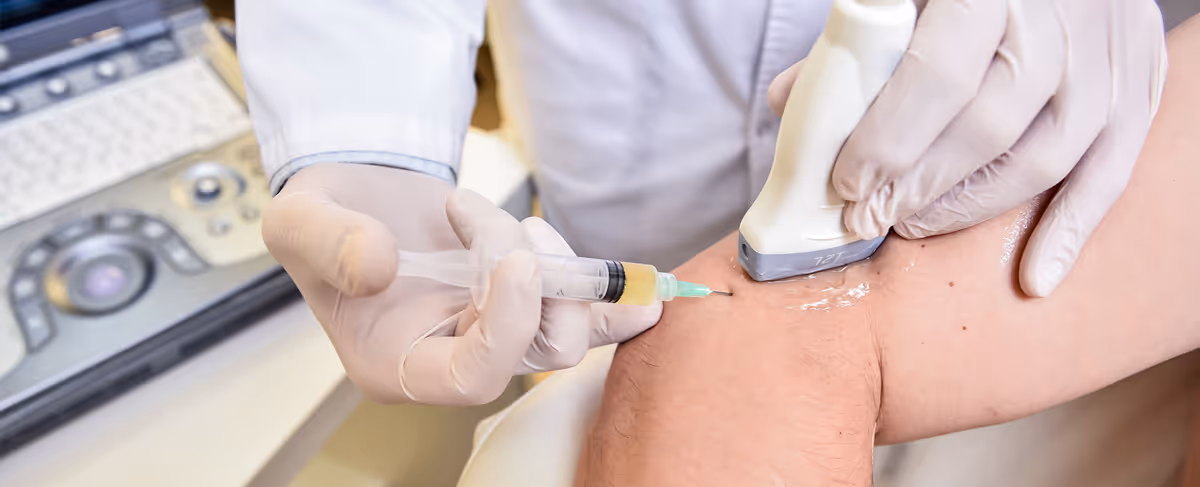 Los Angeles doctor using concentrated platelets in non-surgical treatment to accelerate healing.
