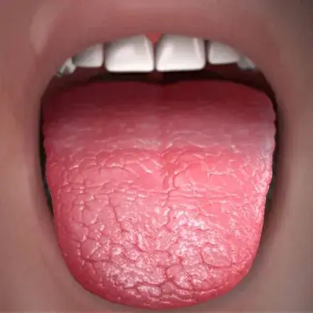 why-is-my-mouth-so-dry