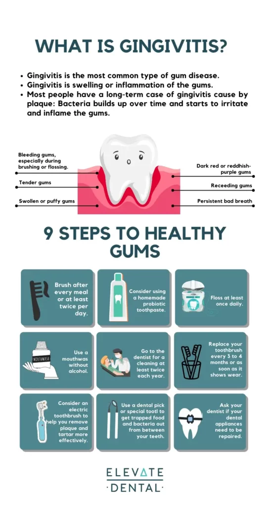 what-is-gingivitis