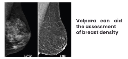 Breast scan imaging of dense and fatty breast tissue
