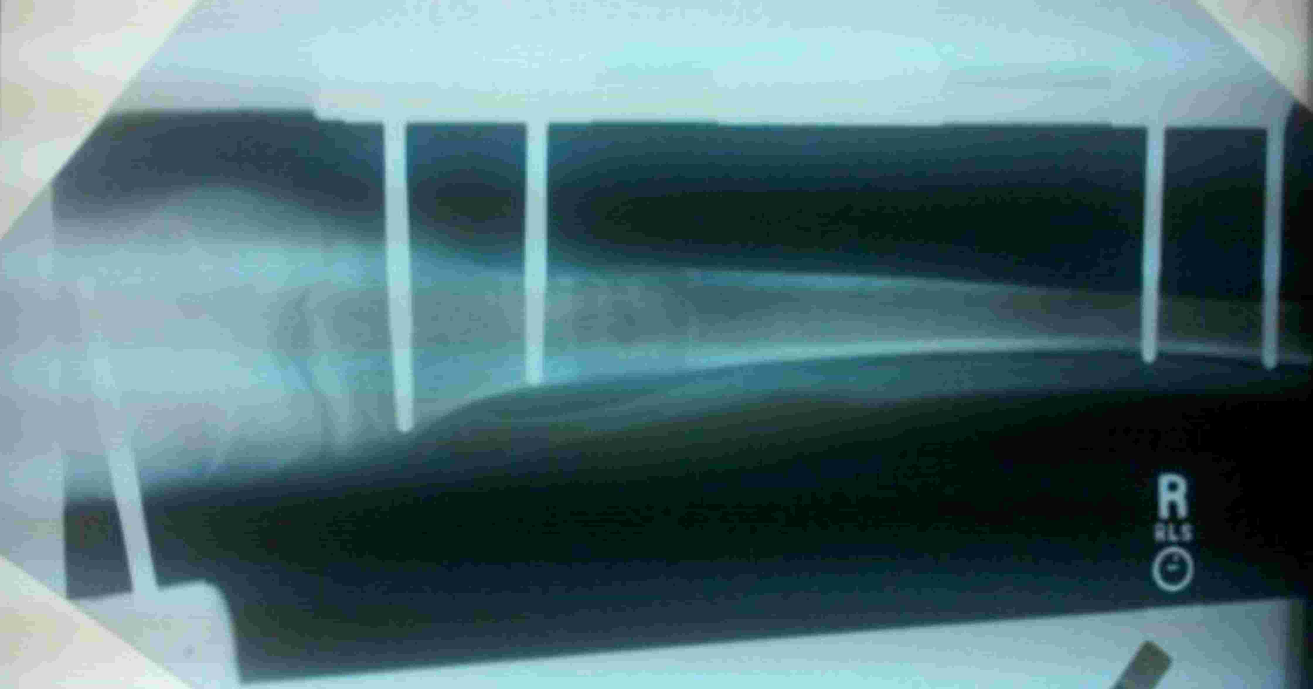 X-ray image of a forearm showing a fractured bone stabilized with four metal rods and screws.