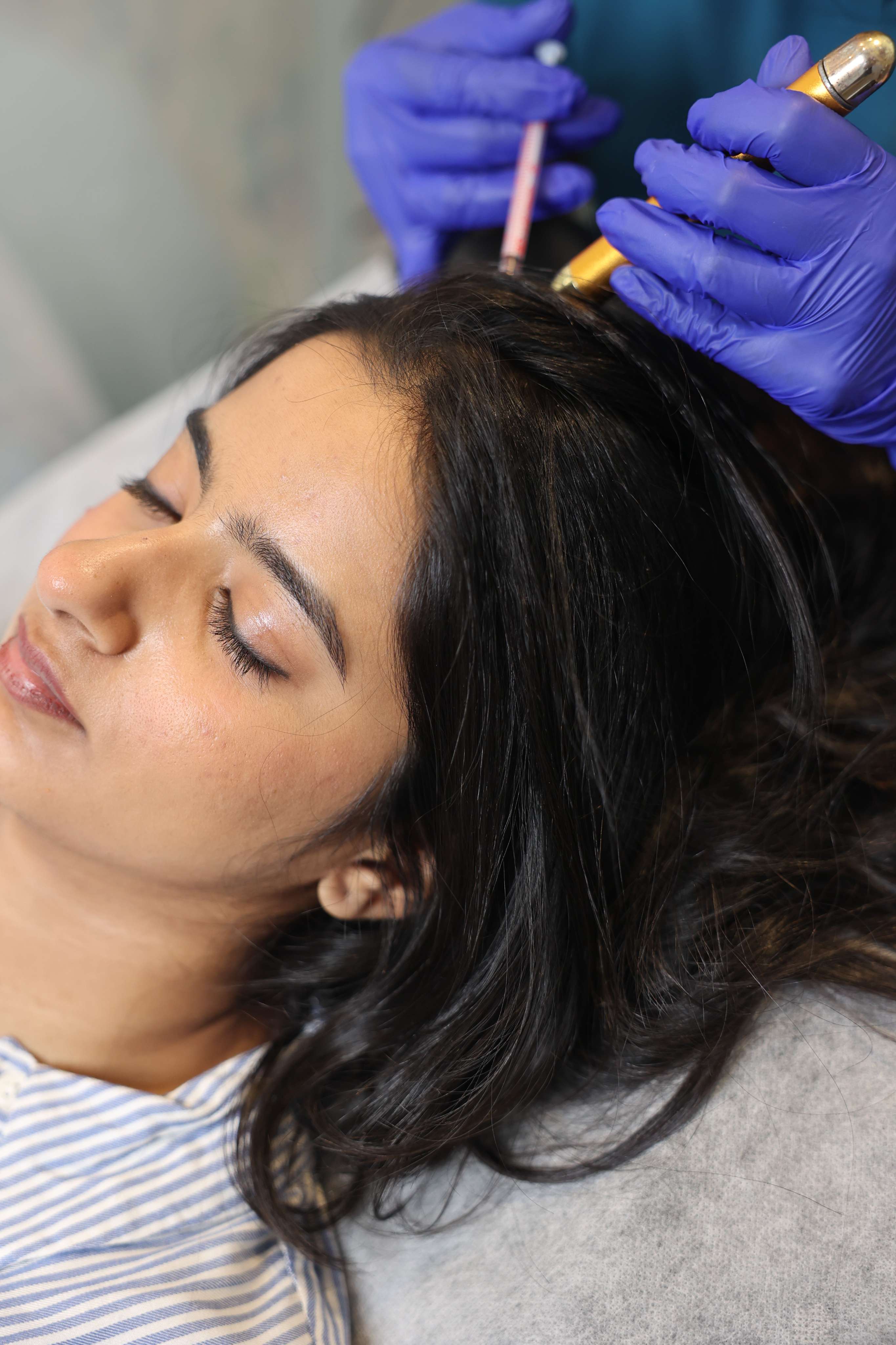 QR678 hair treatment results