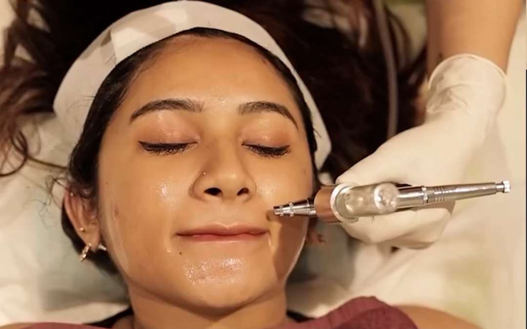O2 Derm skin glow result
