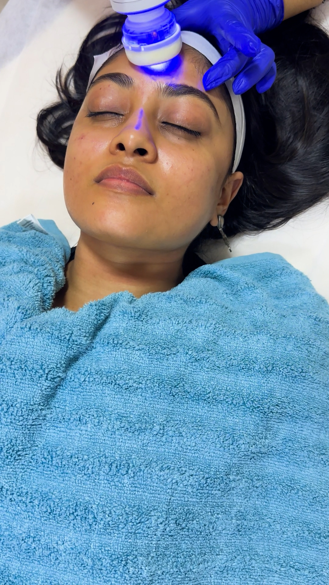 Wishpro facial results