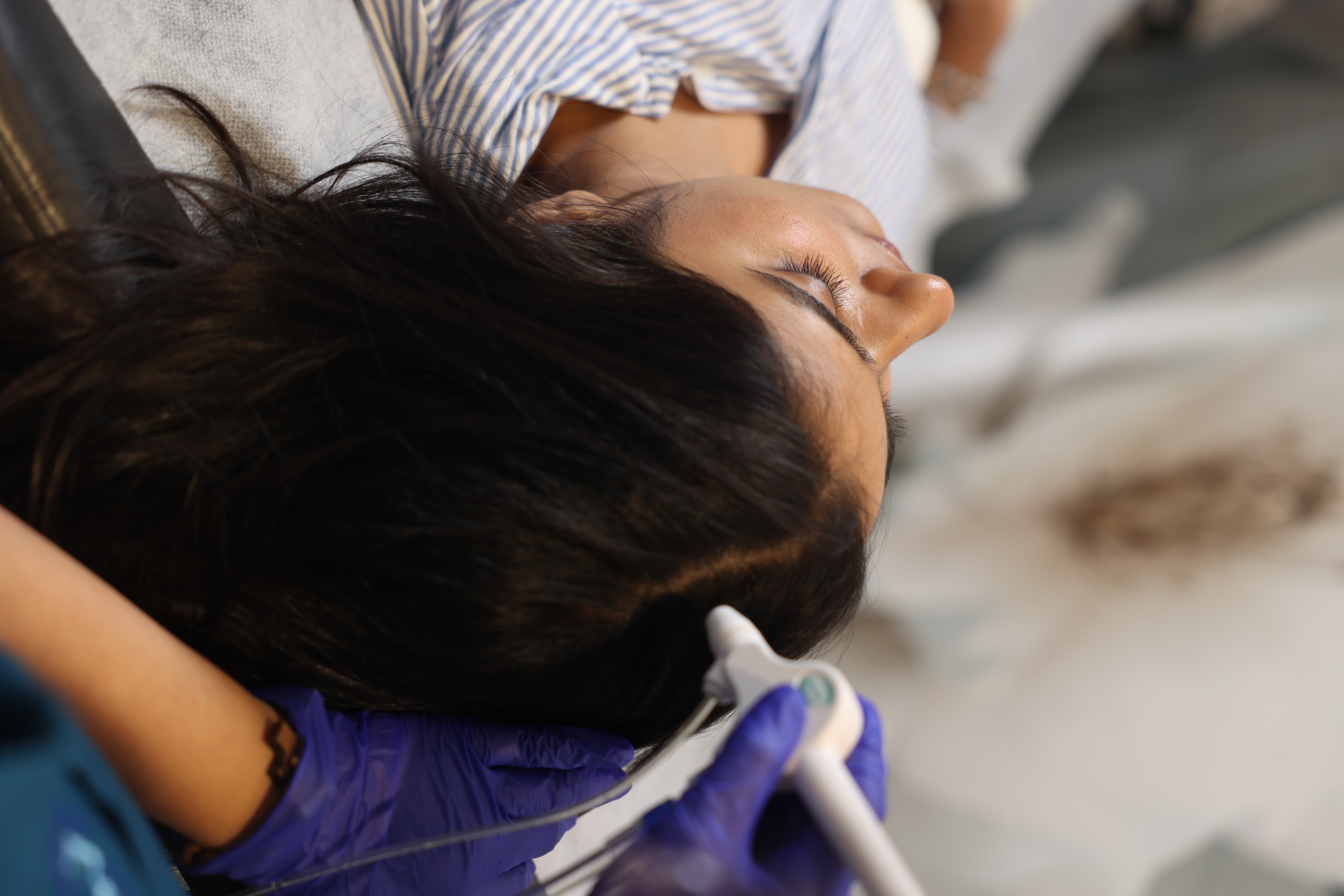 Mesojet hair treatment results