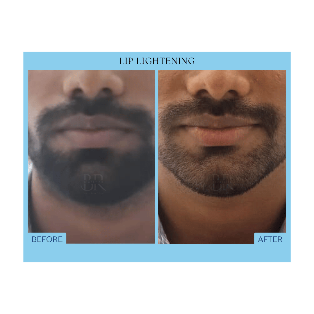 Before and After Result 2