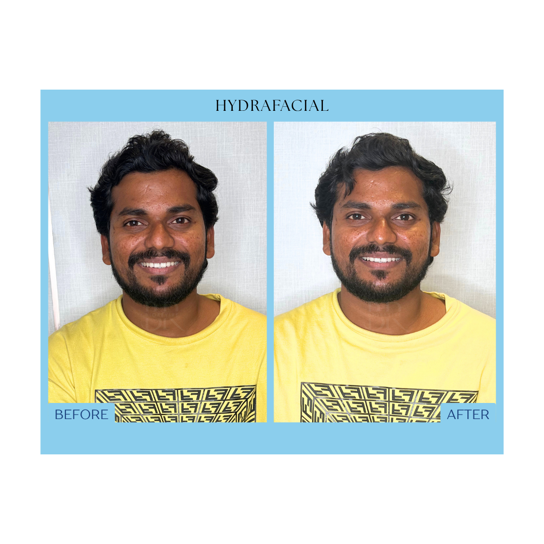 Before and After Result 9