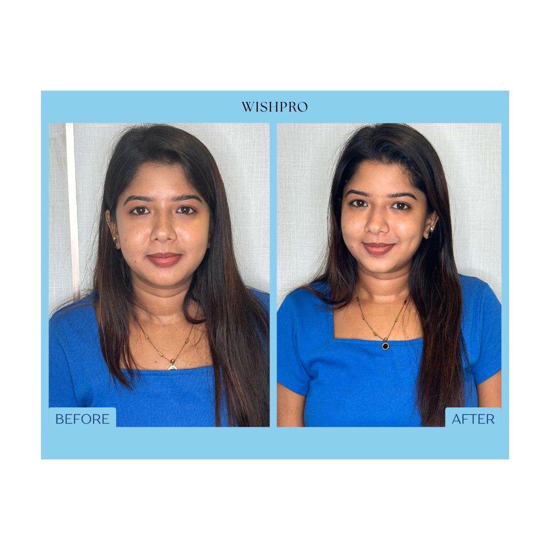 Before and After Result 4