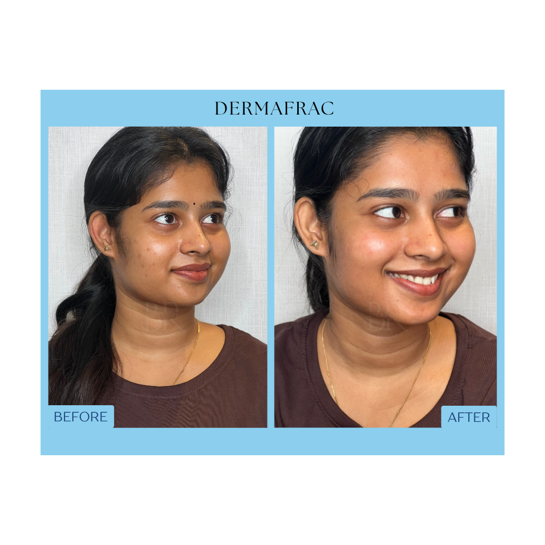 Before and After Result 5