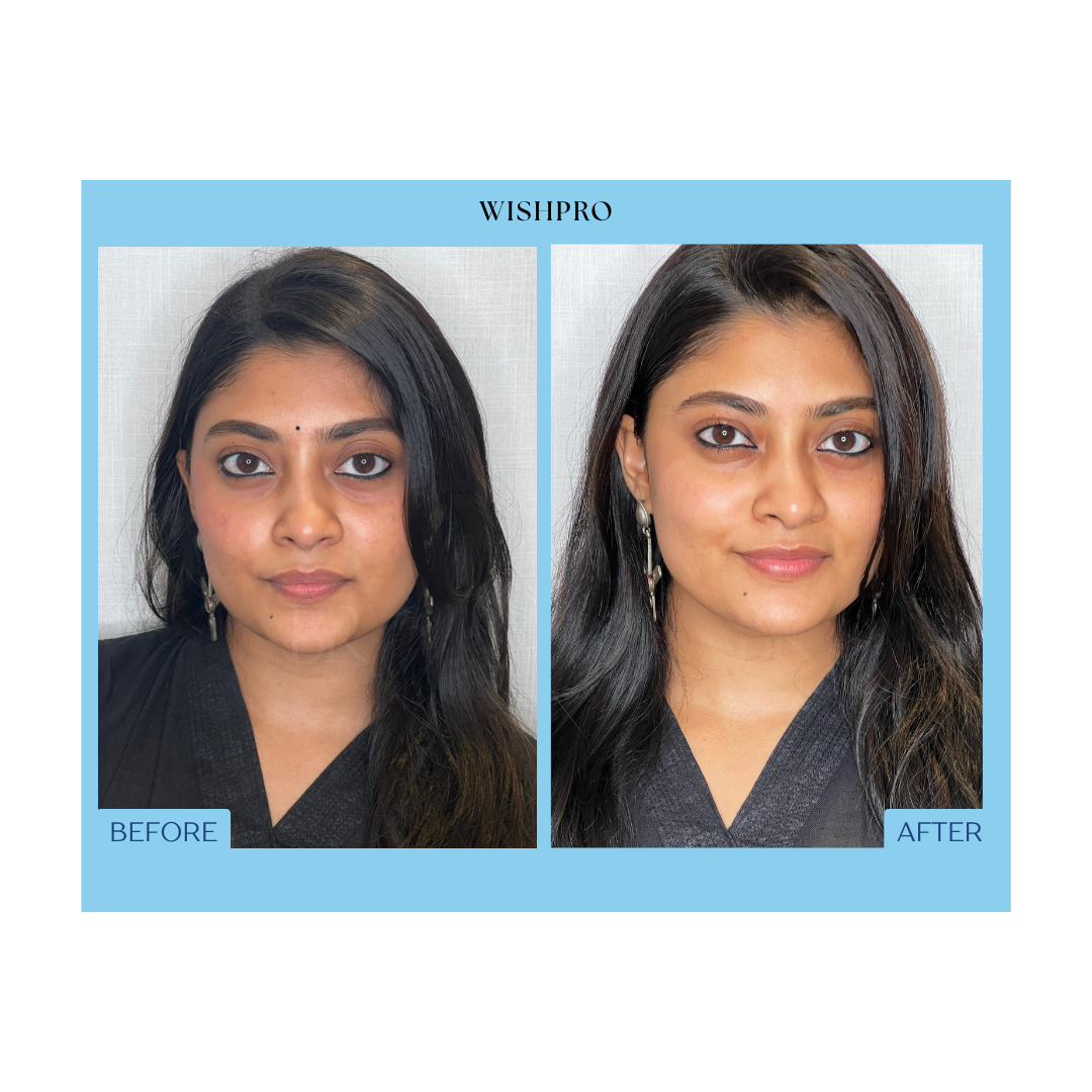 Before and After Result 3