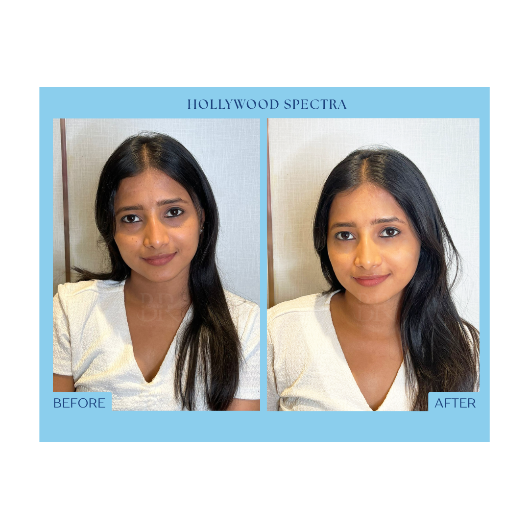 Before and After Result 8