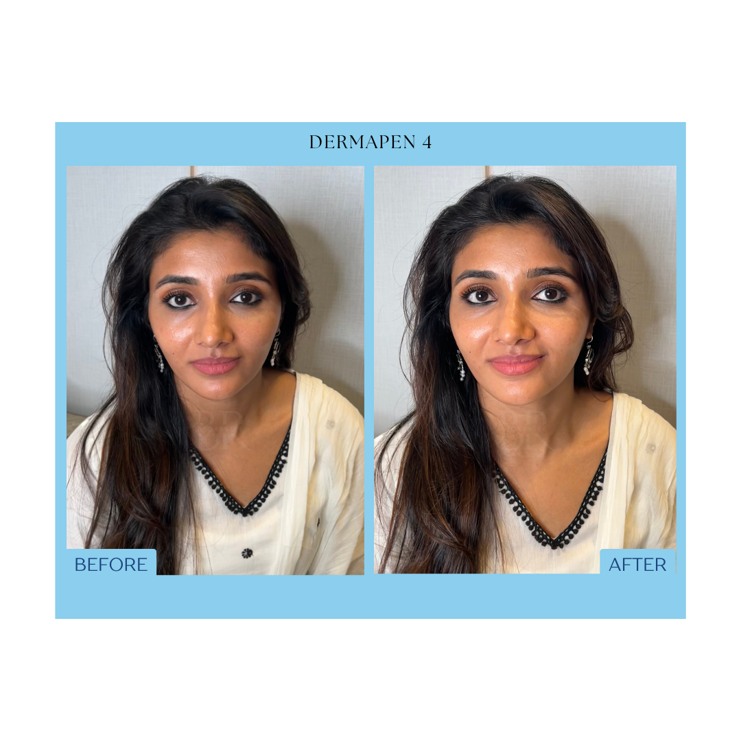 Before and After Result 6