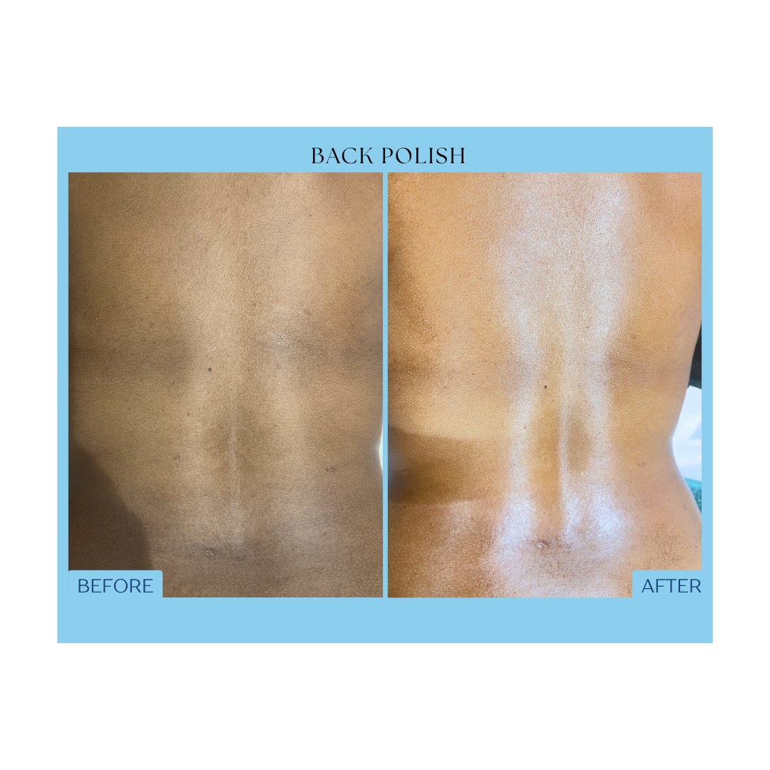 Before and After Result 7