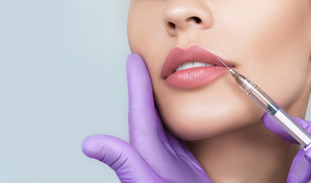 How Lip Fillers Help Make You Look 10 Years Younger