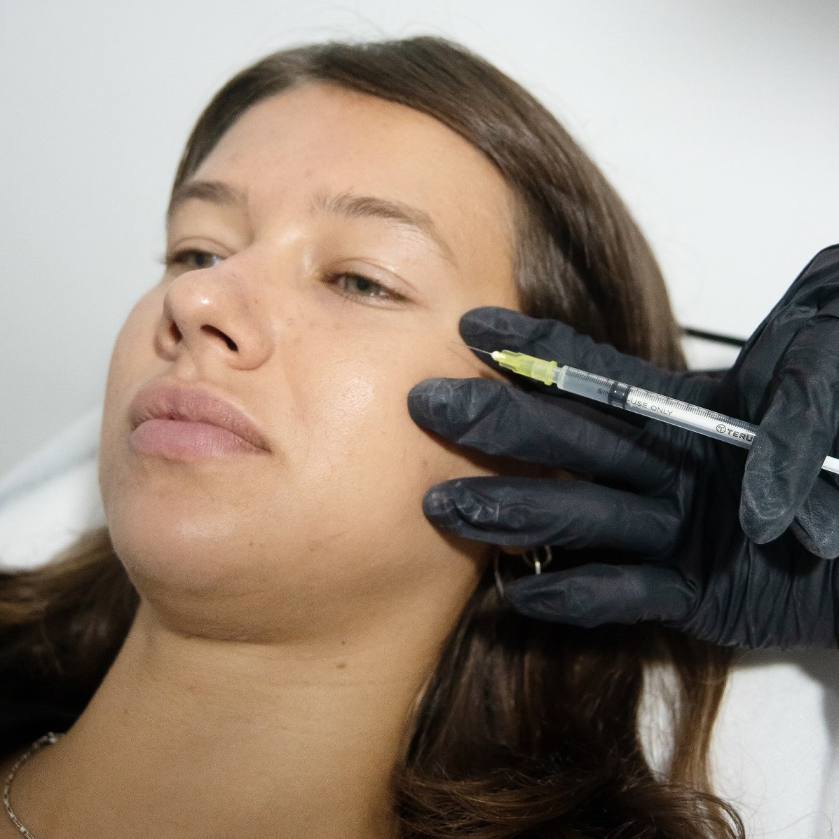 Should You Be Using Skin Boosters