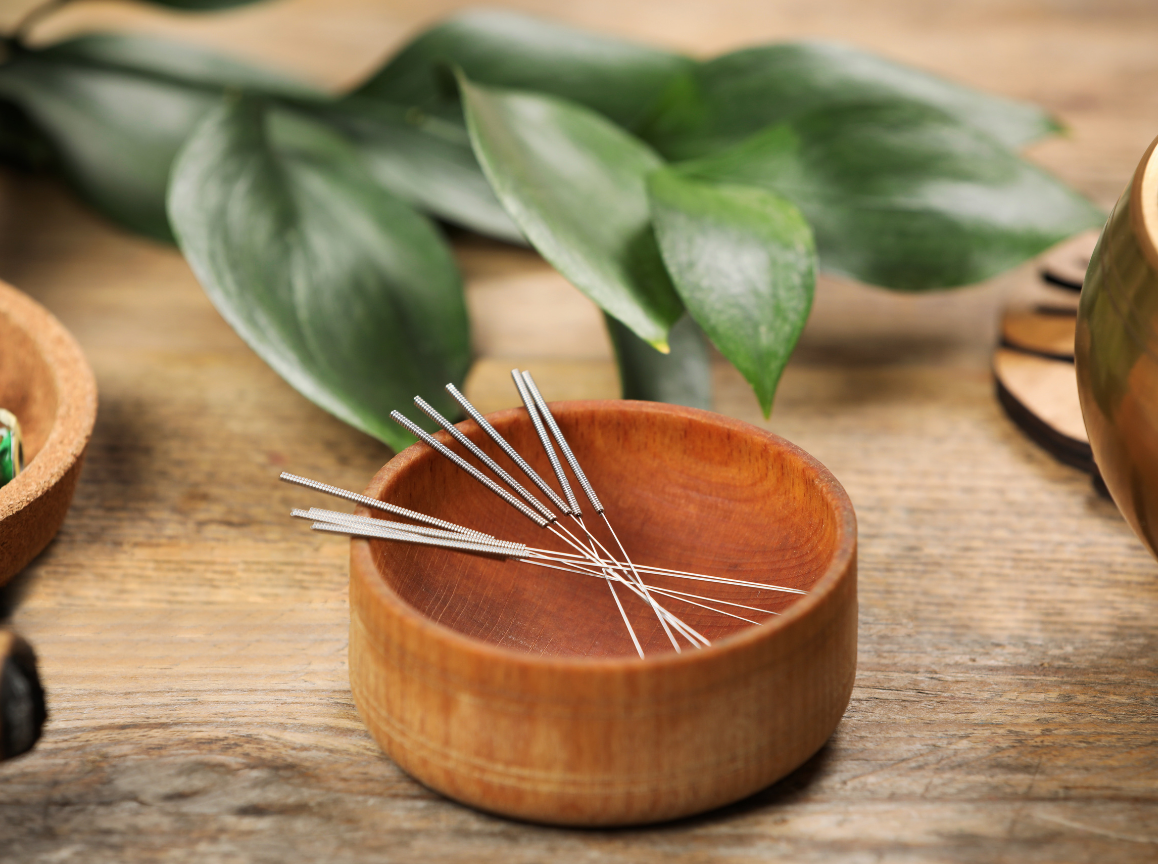 Top 5 Denver Acupuncture Clinics