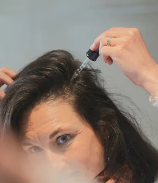 Mulher aplicando tratamento no couro cabeludo com conta-gotas
