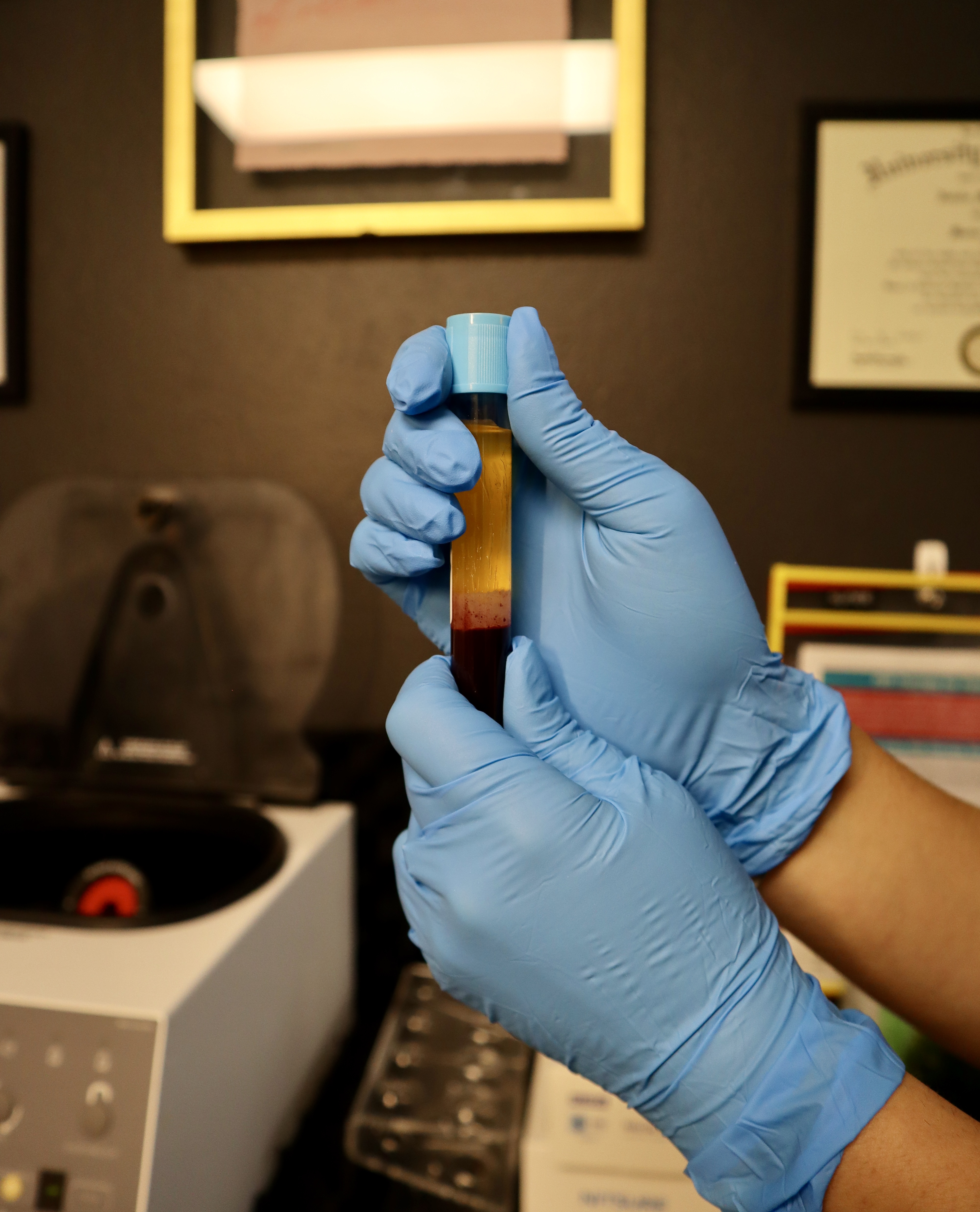 Gloved hands holding a vial of separated platelet rich plasma beside a centrifuge at E&O Wellness in Arvada, Colorado