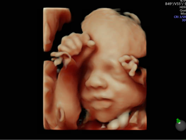 Third Trimester