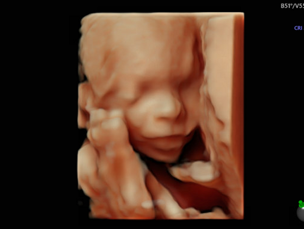 Fetal Survey