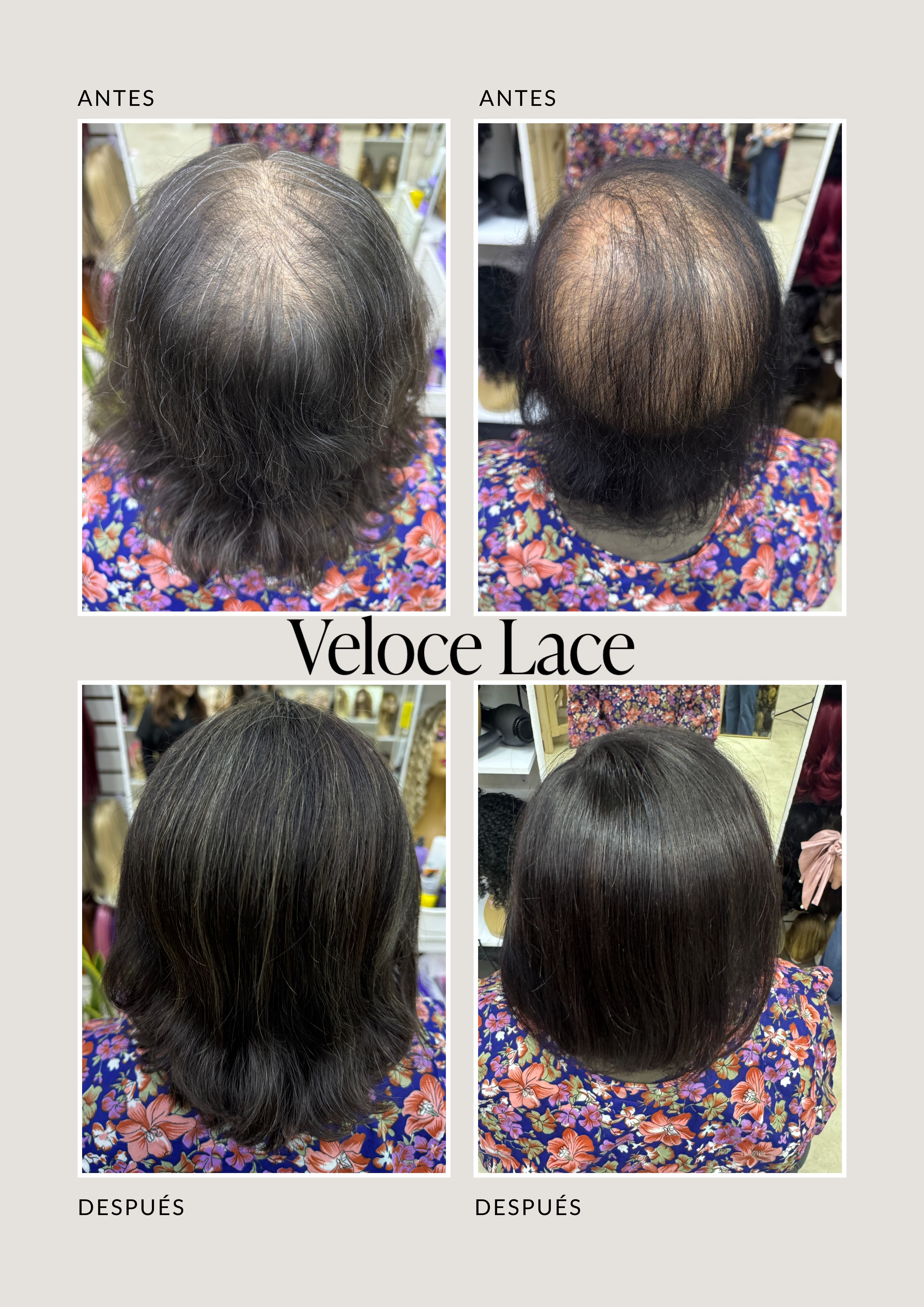 Catálogo de Pelucas Enzo Hair Society