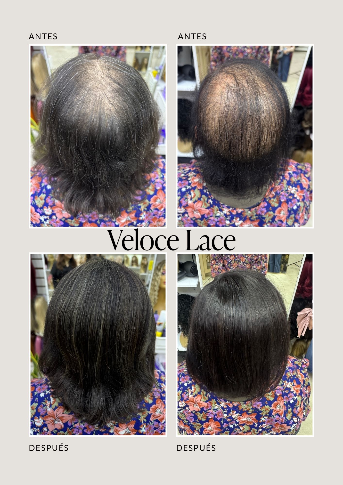 Catálogo de Pelucas Enzo Hair Society