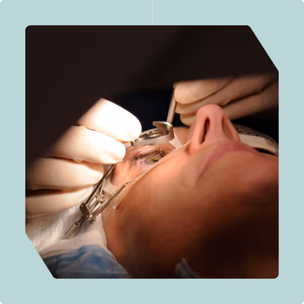 AI-Powered Follow-Ups for Post-LASIK Surgery