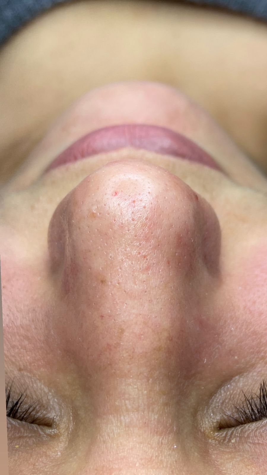 Close-up of a person's nose and closed eyes showing natural skin texture and pores.