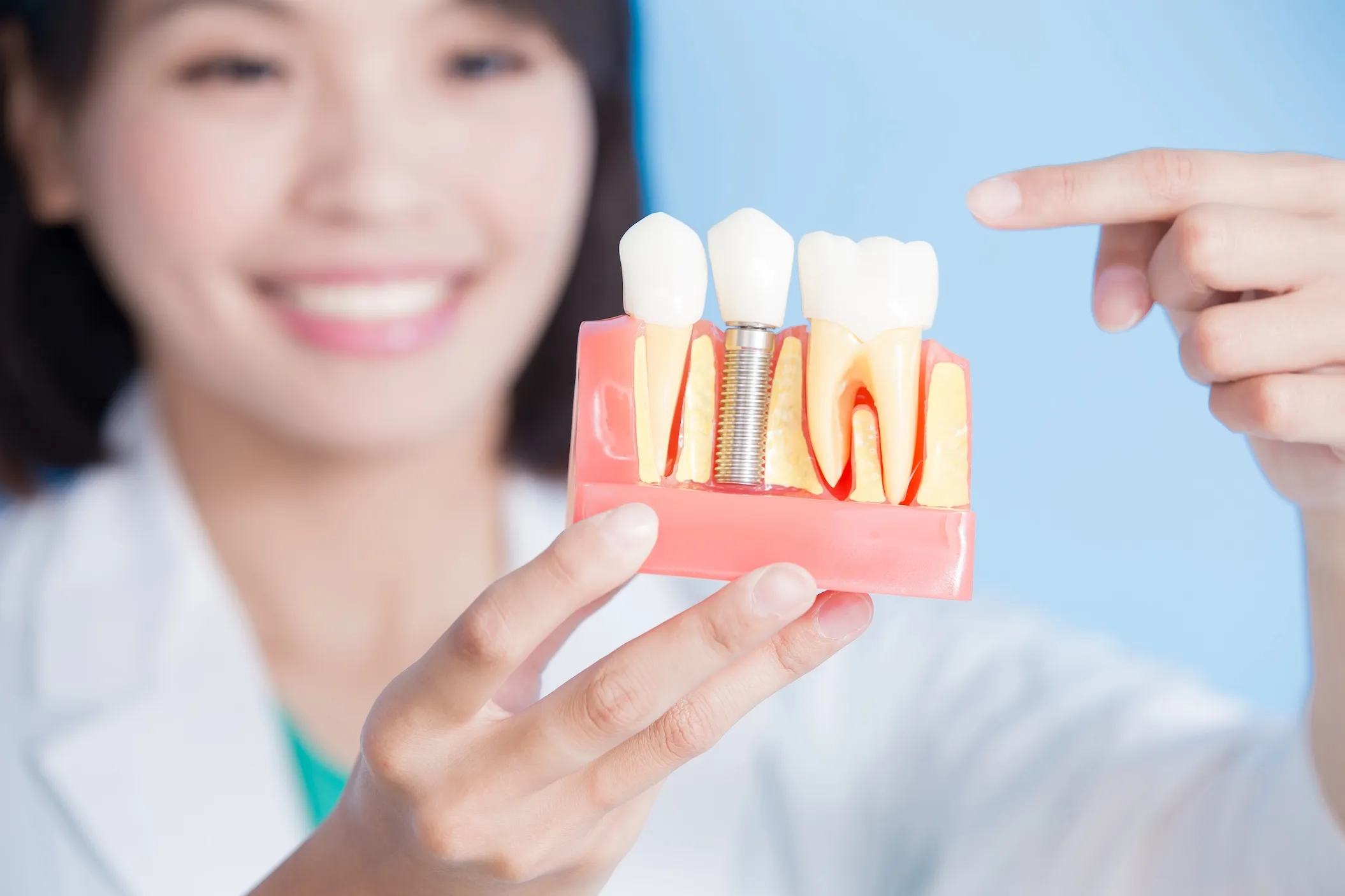 Dental implant procedure at Omnia Dental Care in Chino Hills CA