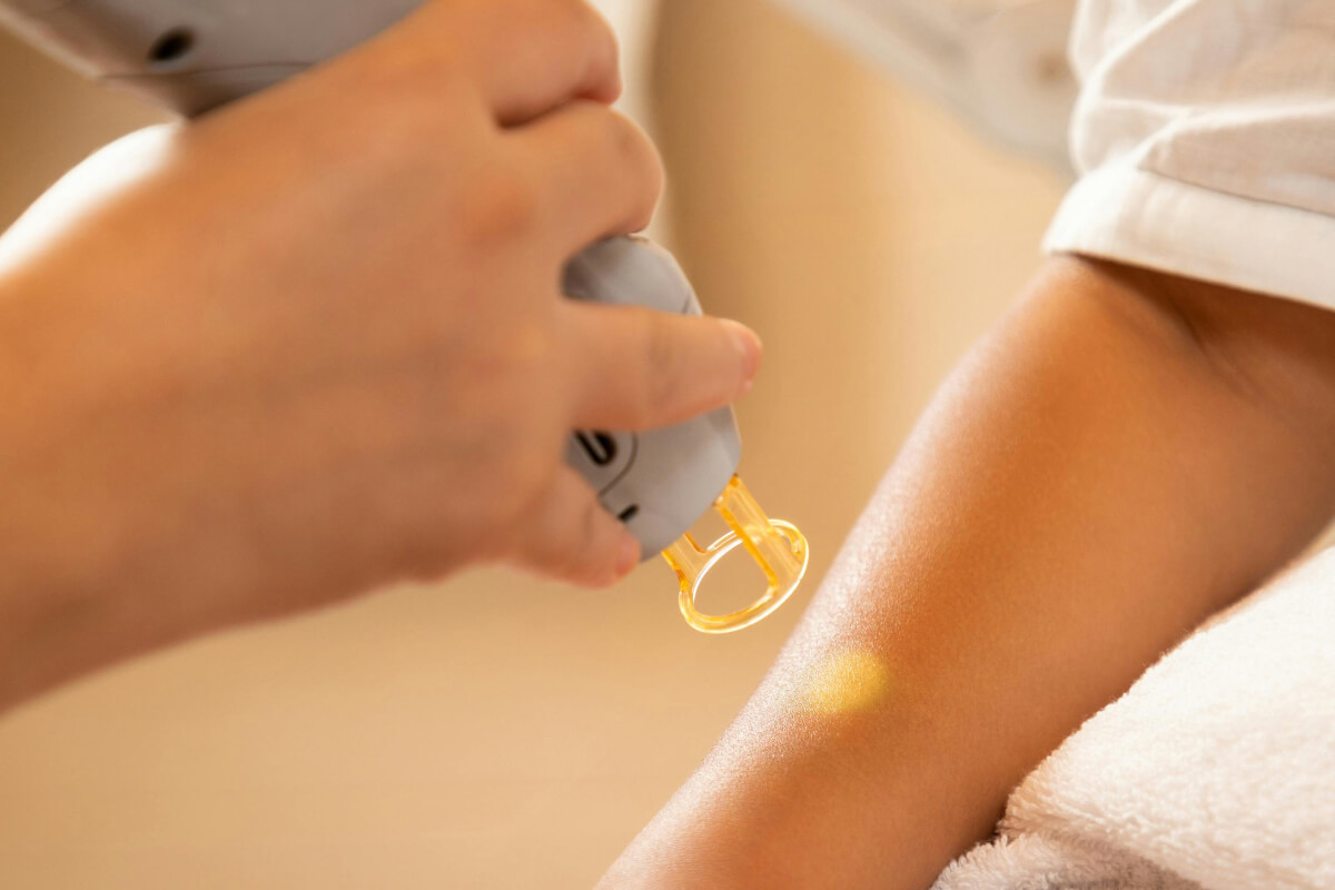 Arm wird mit einem technischen Gerät behandelt.