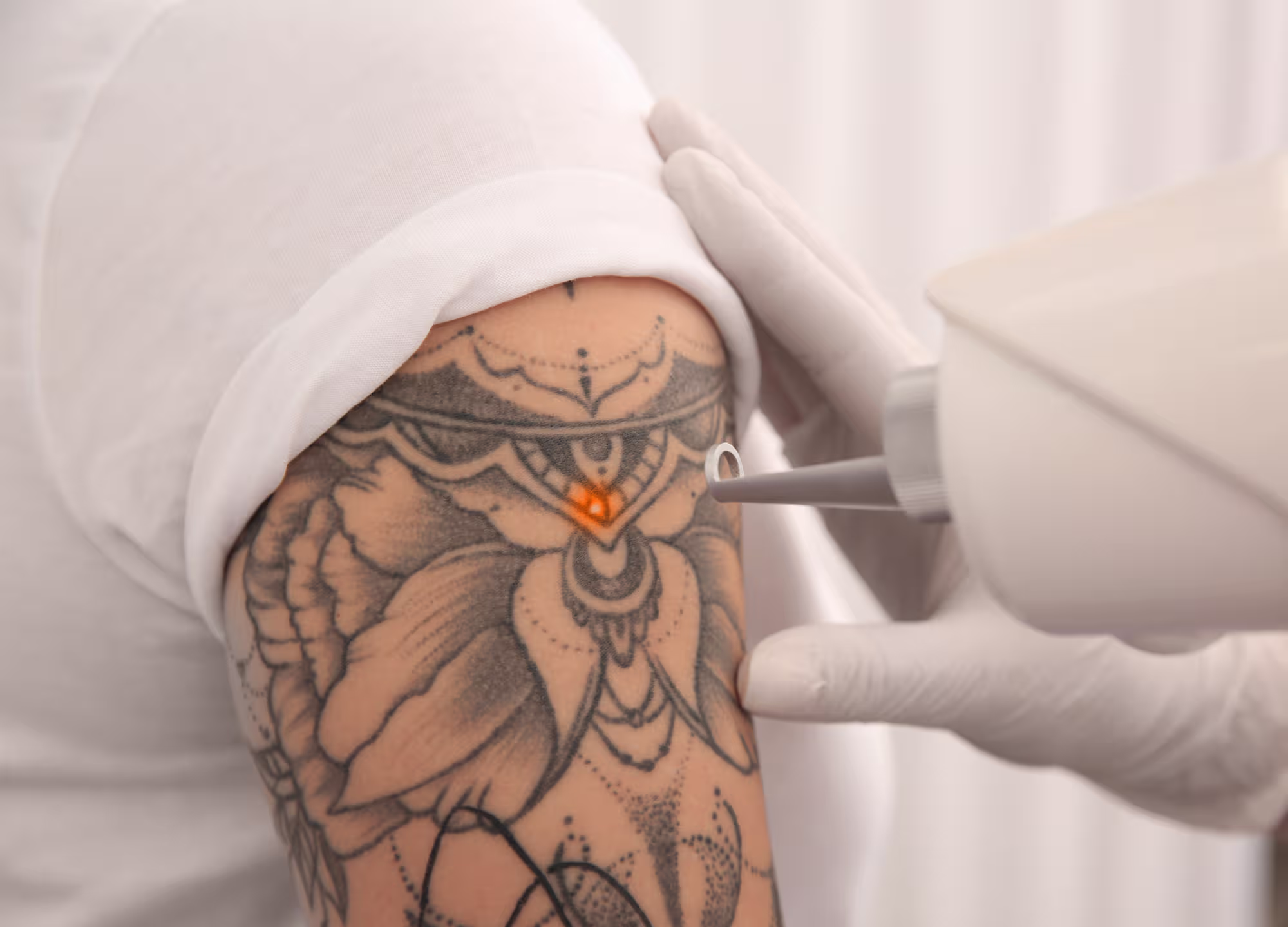 Lip Fillers Dubai: What to Know Before Your First Treatment