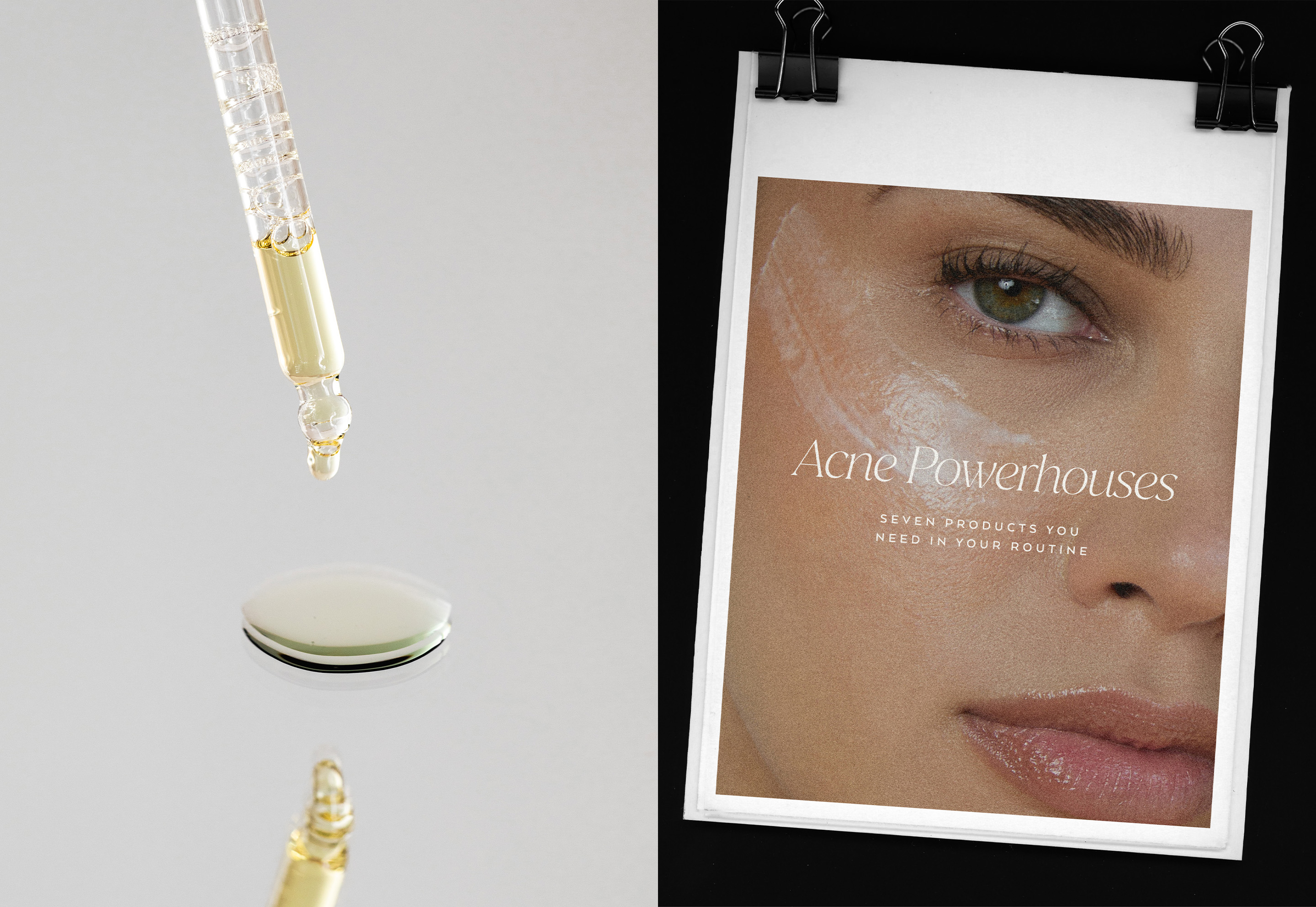 Dropper with serum above surface beside Amaka Aesthetics acne treatment guide, luxury skincare photography.