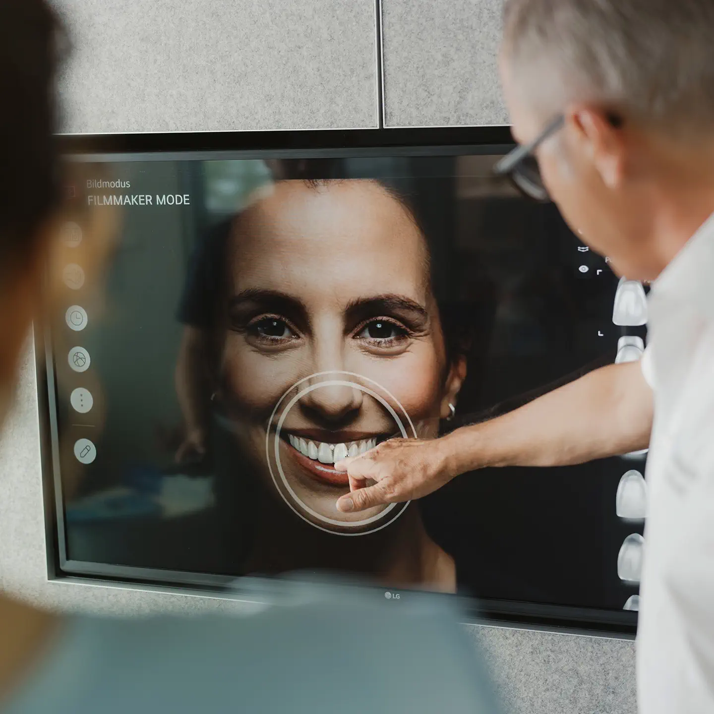 Zahnarzt analysiert Veneer-Planung am Bildschirm mit Digital Smile Design bei Q-Zahnärzte Freiburg