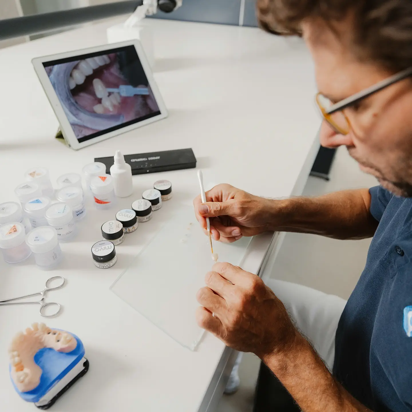 Zahntechniker fertigt individuelle Veneers im Meisterlabor von Q-Zahnärzte Freiburg