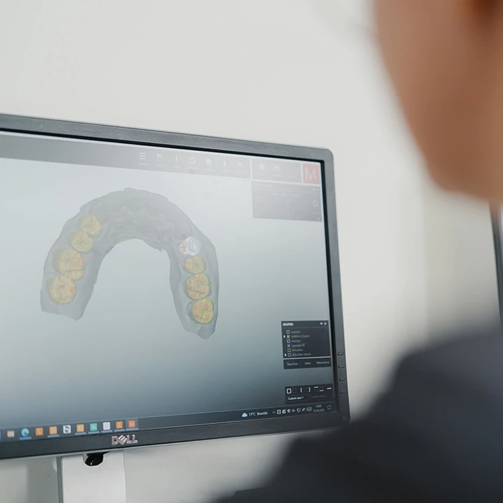 Digitale 3D-Planung der Zahnsanierung am Bildschirm bei Q-Zahnärzte Freiburg