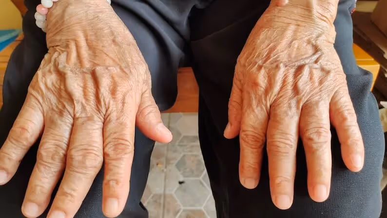 What Your Hands Can Reveal About Your Overall Health