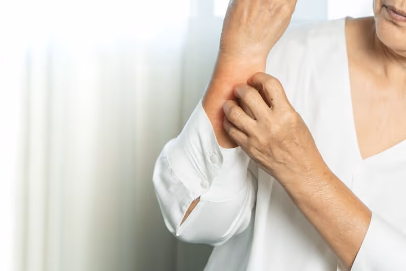 What Is Dermatitis? A Complete Guide for Seniors