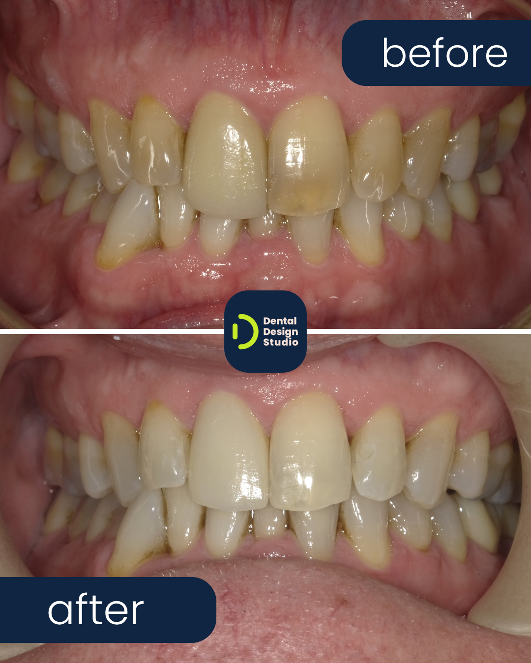 image depicting dental care tips - scene 4