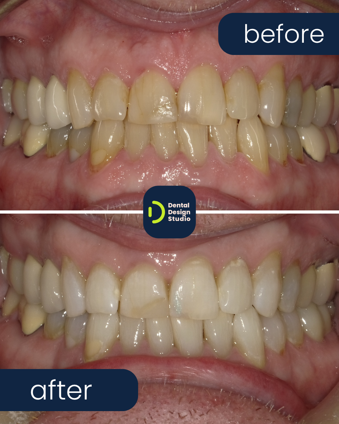image of a dental treatment in progress