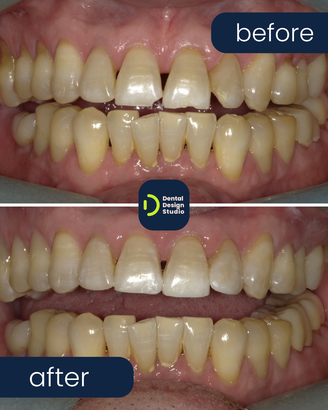 image depicting dental care tips - scene 2