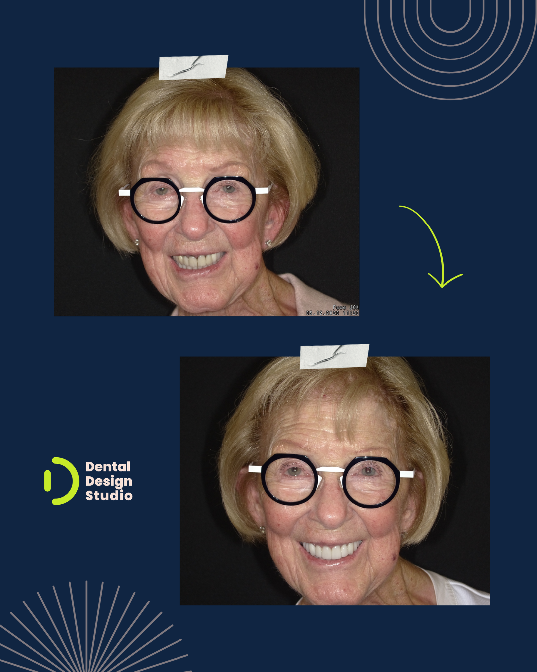 Photo of patient before and after