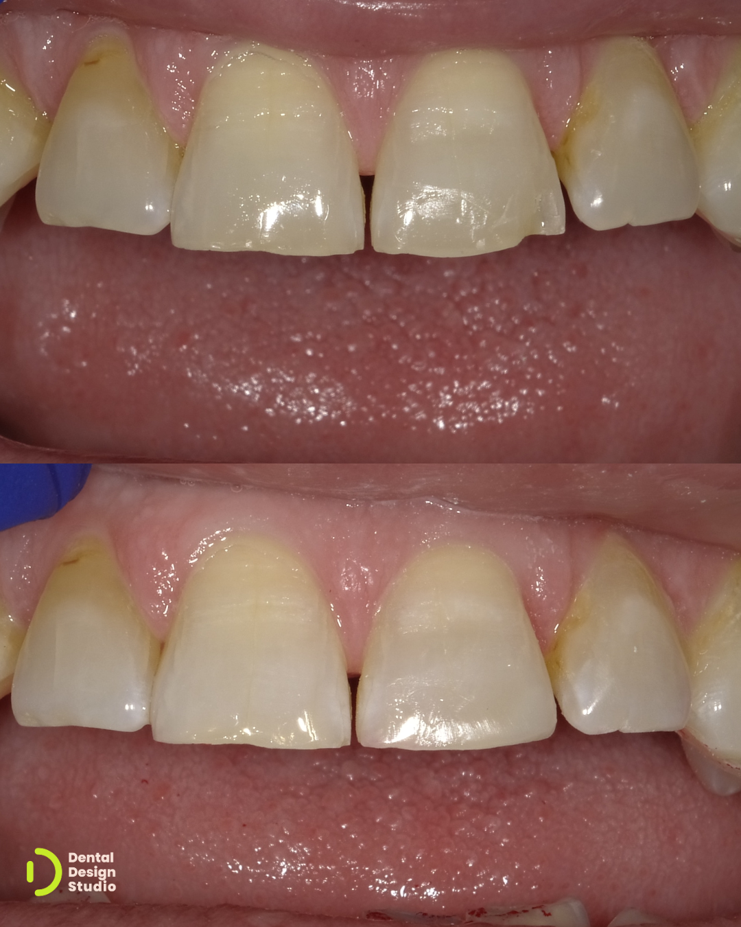 image depicting dental care tips - scene 2