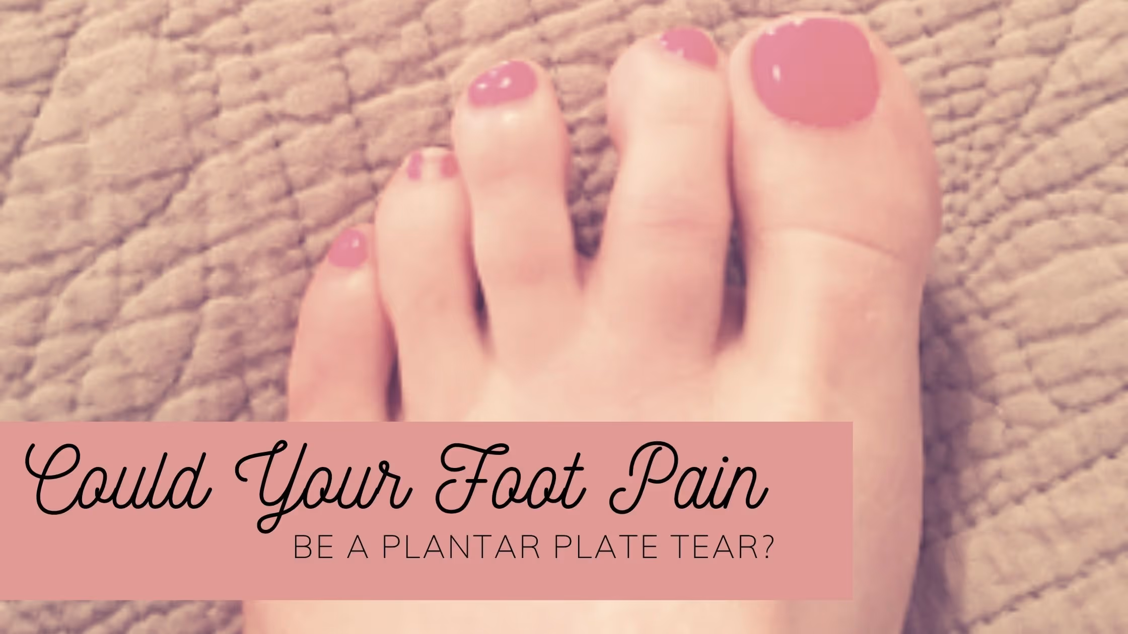 Plantar Plate Injury