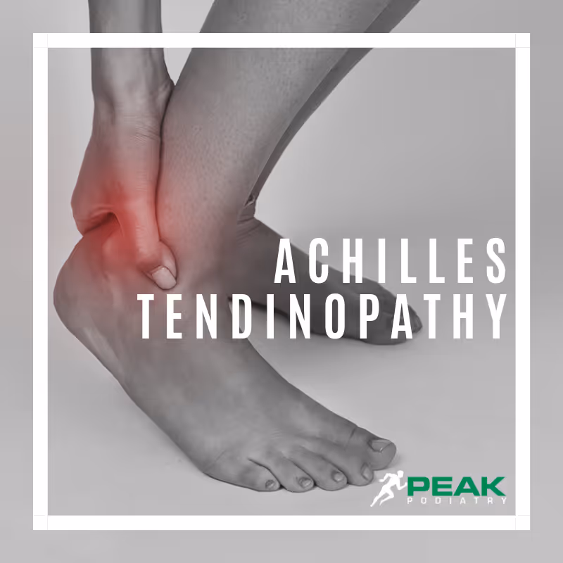 Achilles Tendinopathy