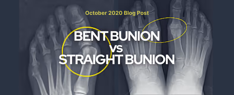 Bent vs Straight Bunion