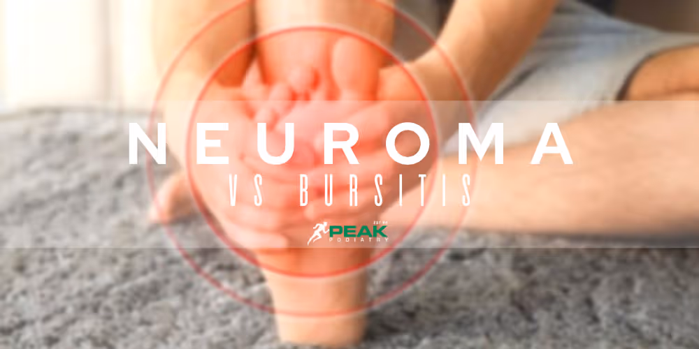 The Difference Between A Morton’s Neuroma And Bursitis