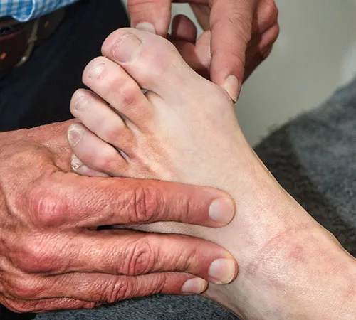 Bunions and Big Toe Joint Pain