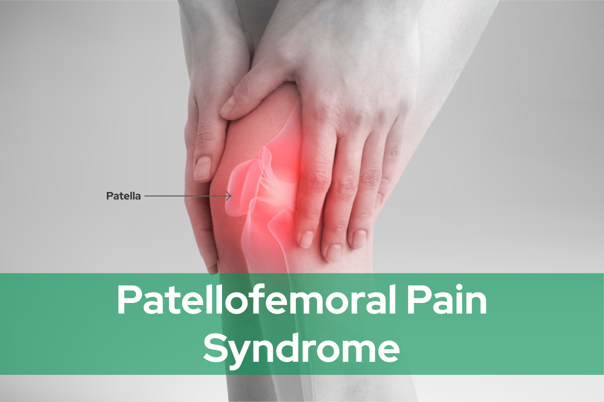 Patellofemoral Pain Syndrome
