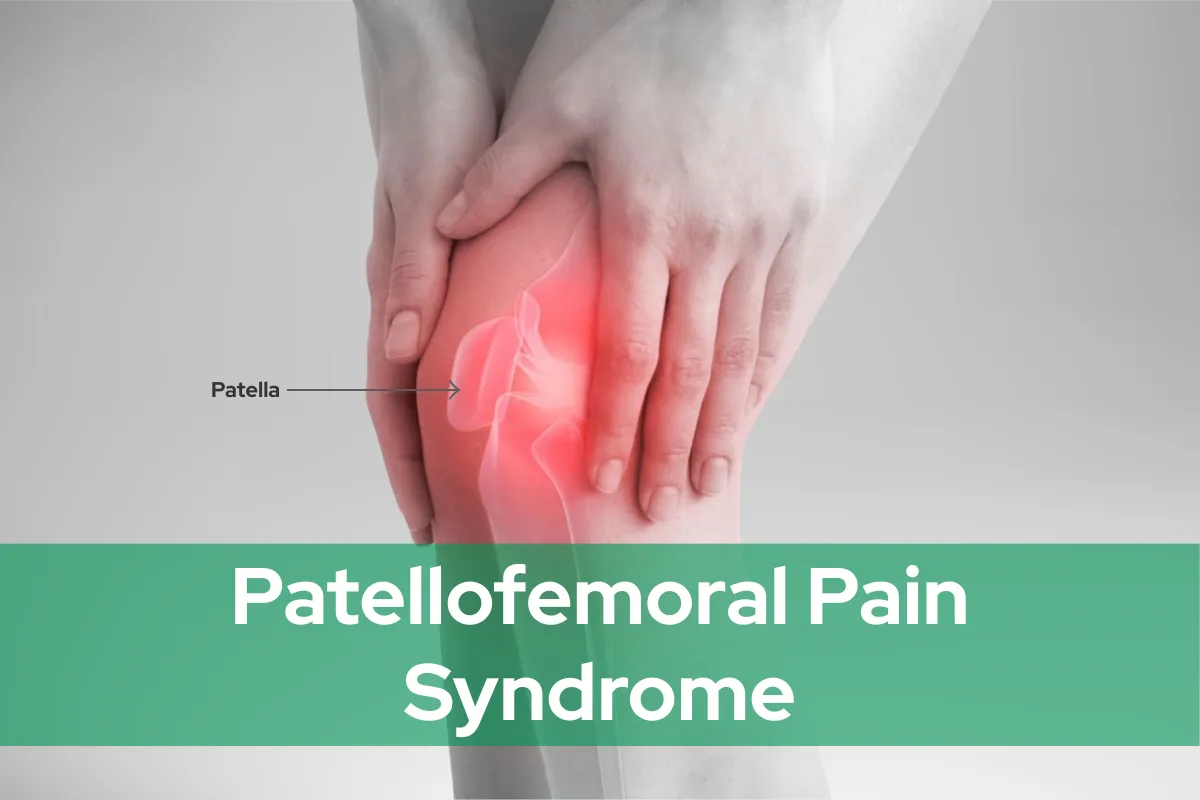 Patellofemoral Pain Syndrome